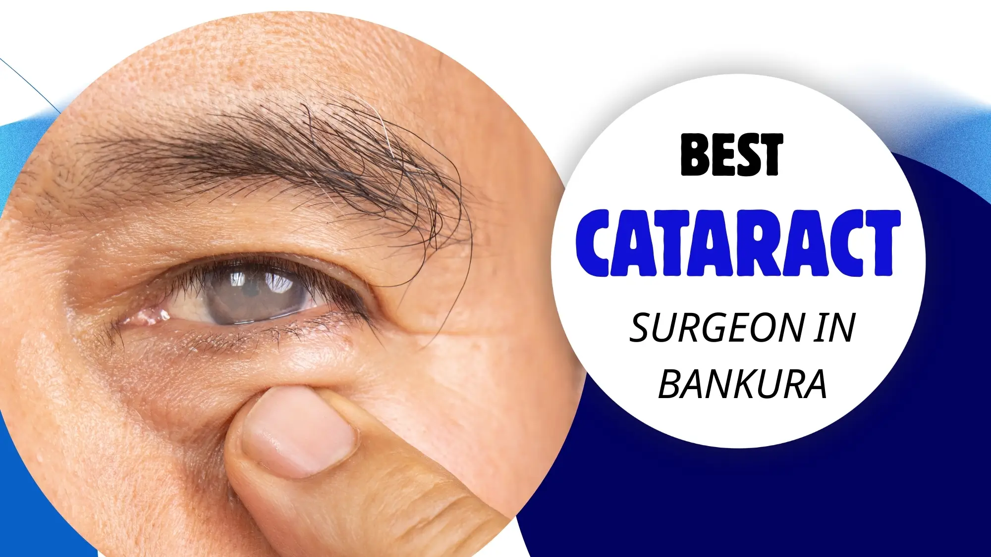 Best Cataract Surgeons In Bankura / Top Cataract Surgeons In Bankura